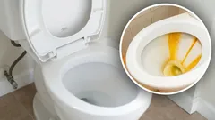Jahrelange Ablagerungen in der Toilette verschwanden: Eine Hausmittel-Mischung aus 3 Zutaten half